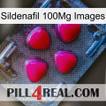 Sildenafil 100Mg Images 13